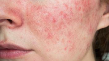 Revelada la íntima relación entre los colores de la cara y tu estado de salud
