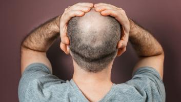 Una investigación española con células madre acerca el fin de la alopecia