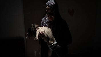 Gaza registra cinco muertes relacionadas con el hambre en un día: van 180 víctimas directas