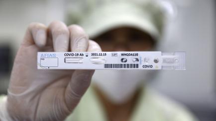 Corea del Sur acelera la producción de test de diagnóstico del COVID-19.