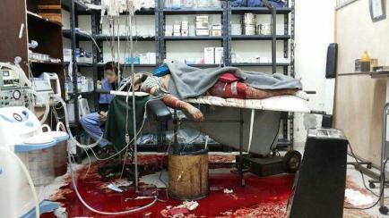 Un hombre gravemente herido yace en una mesa de operaciones en un hospital improvisado en un distrito asediado del este de Damasco. "Dormir y descansar era un lujo imposible", decía el Dr. S., un joven cirujano que se graduó en los p...