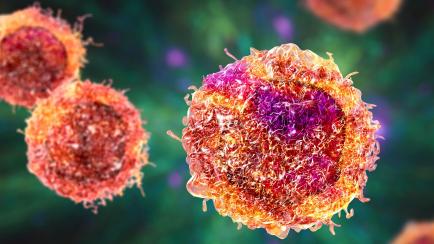 Ilustración de una célula cancerígena