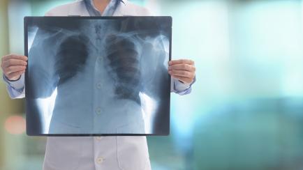 doctor radiology looking chest x-ray film of lung disease patient at hospital ward.