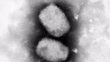 El virus de la viruela del mono.