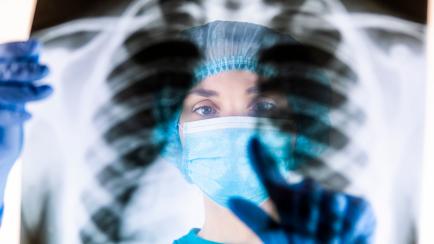 Médico mirando una radiografía de unos pulmones.