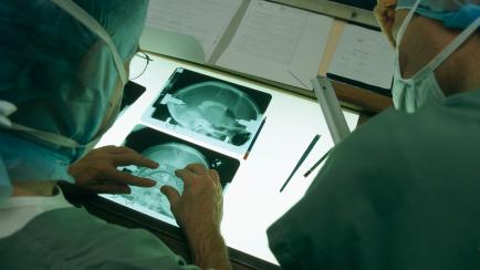 Médicos introduciendo un implante cerebral en una imagen de archivo.