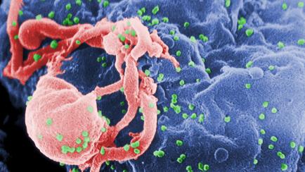 Imagen a escala de varias rondas del virus de inmunodeficiencia humana en una célula. 