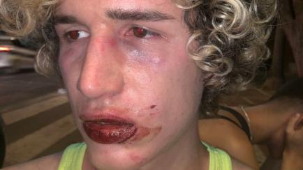 Imagen del joven, sangrando tras la agresión. 