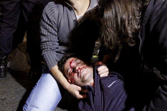Uno de los heridos durante la protesta