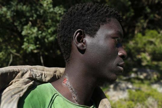 Mustapha, de Gambia, afirma que sus heridas fueron infligidas por la policía marroquí en su escondite en las montañas ceutíes.
