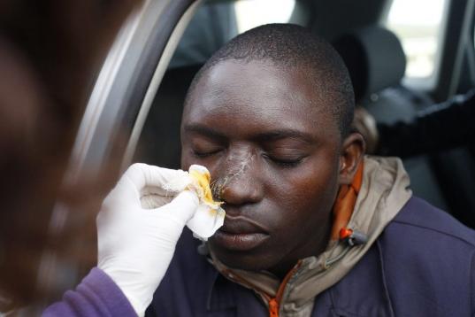 Mohamed, un joven de 23 años de Togo, recibe cuidados médicos en una carretera entre Tangier y Ceuta. Mohamed afirma que sus heridas fueron causadas intentando entrar en España el pasado 6 de febrero, en el que al menos 15 africanos murieron ...