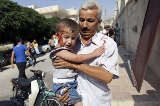 Según datos recogidos por Save The Children en uno de los hospitales que tiene instalados en Siria, el 24% de los pacientes que ingresan son menores de 14 años. La mayoría llega con quemaduras graves, heridas profundas y fracturas abiertas pr...