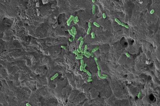 Listeria monocytogenes (en verde) en cecina de pavo.