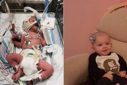 "Mis hijas gemelas, Stevie y Harper, nacieron a las 34 semanas y pasaron tres más en el hospital. Tenían problemas respiratorios, y dificultades a la hora de comer y de mantener la temperatura corporal. Tuvimos mucha suerte de que el personal ...