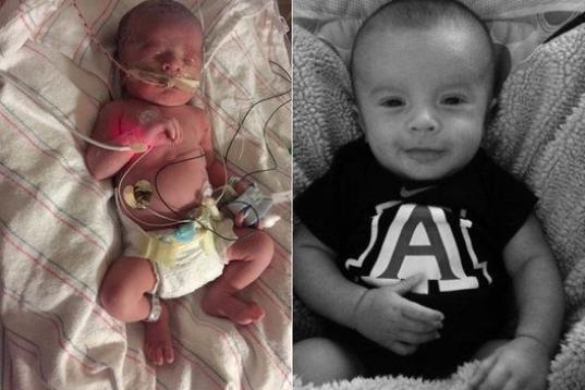 "Mi hijo Seth Thomas Pender Jr. nació el 2 de agosto de 2015, a las 33 semanas de embarazo. Pasó 16 largos días en la Unidad de Cuidados Intensivos Neonatales. Al nacer, pesó 2,8 kilos, pero llegó a pesar 2,1 kilos estando en la UCIN. Ahora...