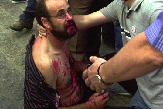 Piquete herido tras un enfrentamiento con la policía en la huelga general de 2002 frente a la sede de UGT en Madrid.
