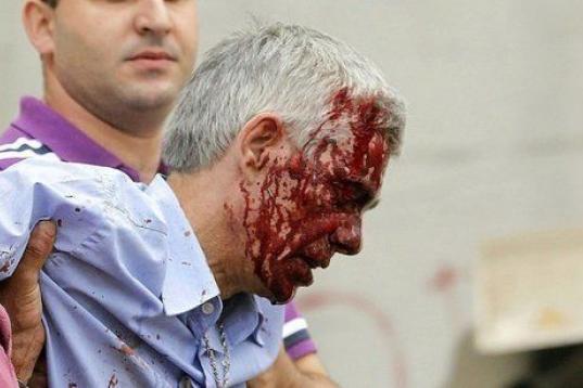 Francisco José Garzón Amo, maquinista del tren, con el rostro ensangrentado instantes después del accidente 