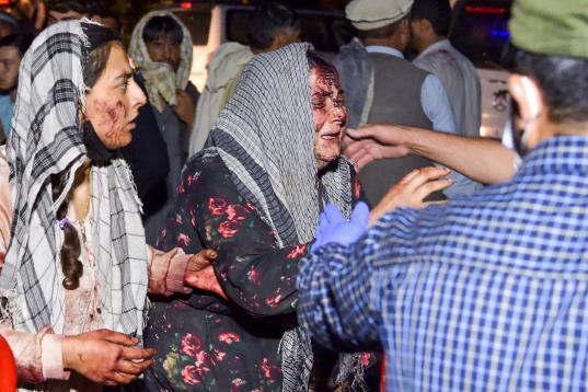 Dos mujeres, ensangrentadas tras resultadas heridas por las explosiones