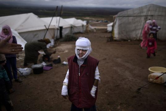 En esta foto de archivo del 11 de diciembre de 2012, Abdullah Ahmed, de 10 años, que sufrió quemaduras en un ataque aéreo del gobierno sirio y huyó de su casa con su familia, posa afuera de su tienda de campaña en un campo de refugiados sir...