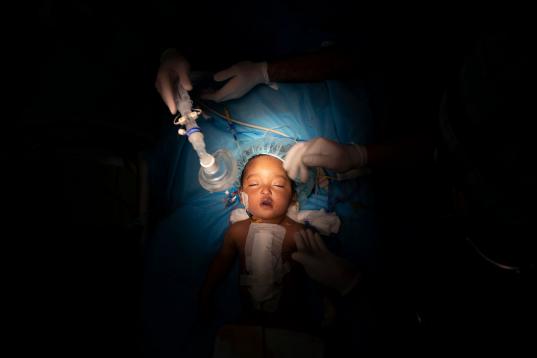 Yazan, una niña de un año residente en el desierto, operada en Libia por el equipo del doctor William Novick, que ayuda a personas sin asistencia. 