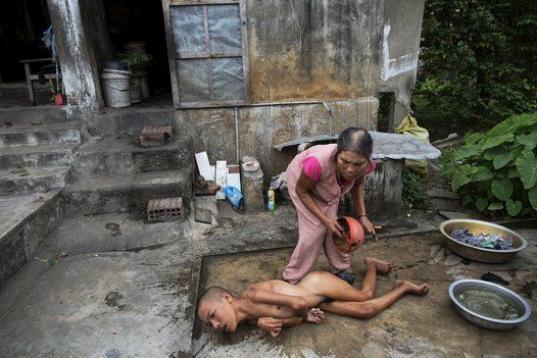 Tang Thi Thang baña a su hijo Doan Van Quy ante su vivienda en Truc Ly. El padre del menor fue militar, destinado en zonas donde se empleó el agente. Los dos hijos de la familia nacieron con discapacidades. 