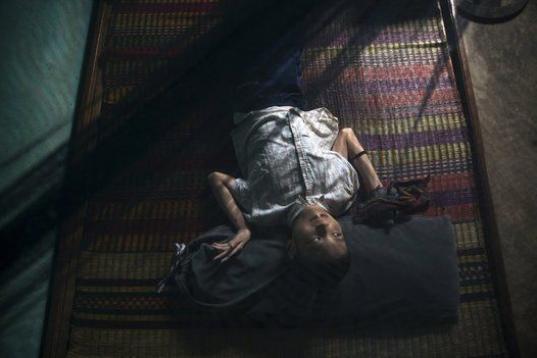 Le Dang Ngoc Hung, de 16 años, que sufre problemas físicos y mentales, descansa en su casa de Phuoc Thai. Su abuelo, militar, dice que fue expuesto reiteradamente al agente naranja e incluso fue rociado directamente por aviones militares de EEUU. 