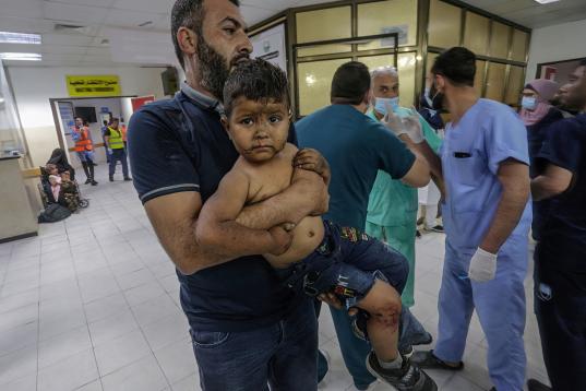 Un niño palestino herido, en el hospital Al-Shifa para recibir tratamiento después de un ataque aéreo israelí en la ciudad de Gaza.