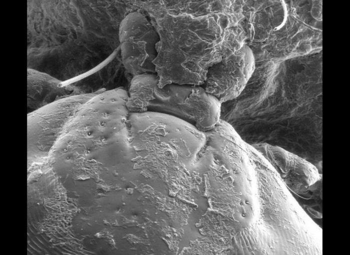 Imágenes con microscopio: café, arañas y pan convertidos en espectáculos visuales (FOTOS)