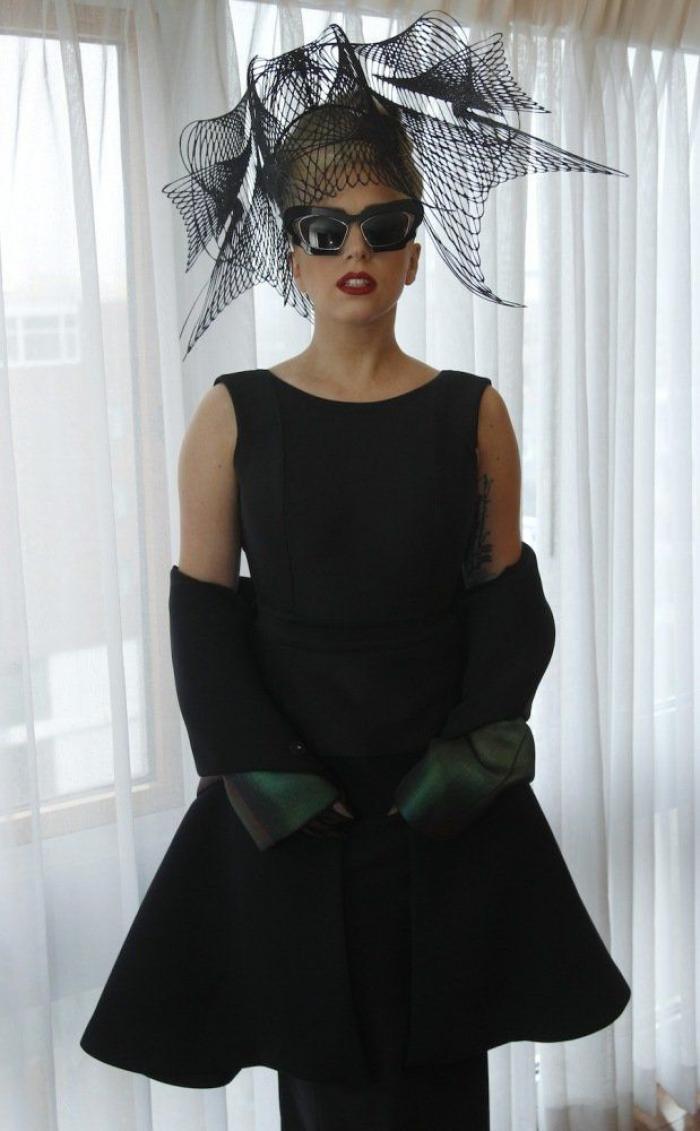 Lady Gaga: operación de cadera a la vista y gira cancelada (FOTOS)