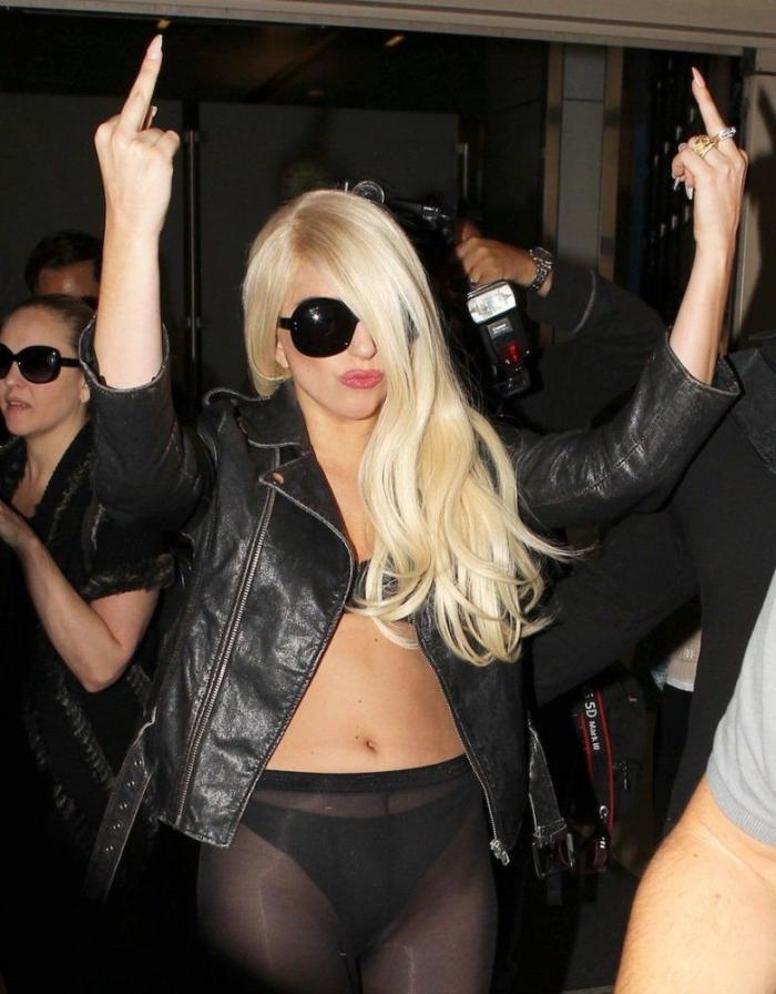 Lady Gaga: operación de cadera a la vista y gira cancelada (FOTOS)