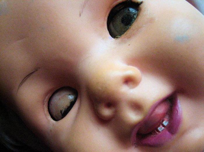 Una niña tiene una brutal reacción alérgica a un maquillaje infantil