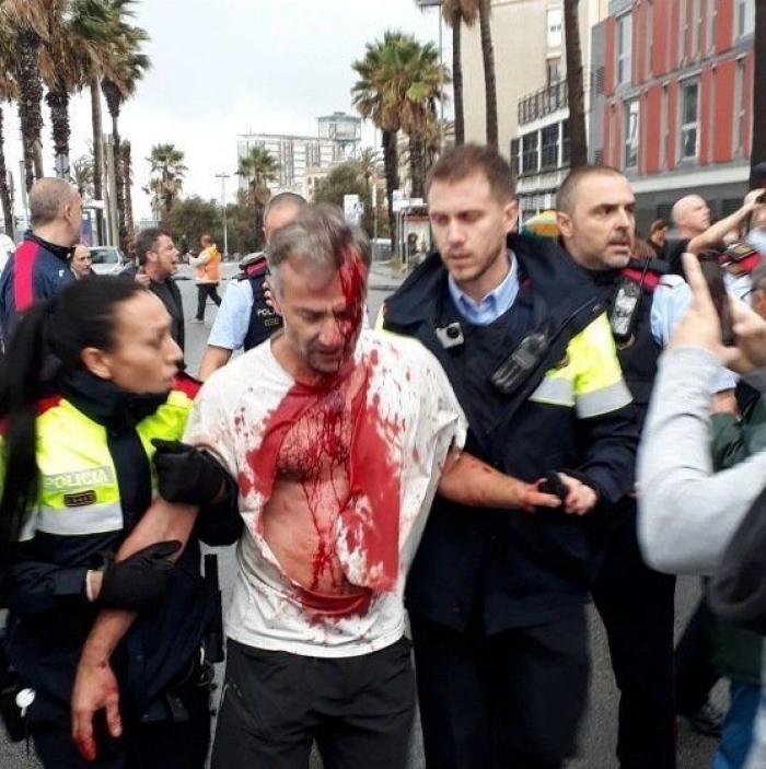 FOTOS: Así fueron las cargas policiales el 1-O