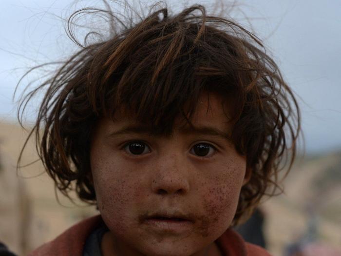 Los rostros de la tragedia en Afganistán (FOTOS)