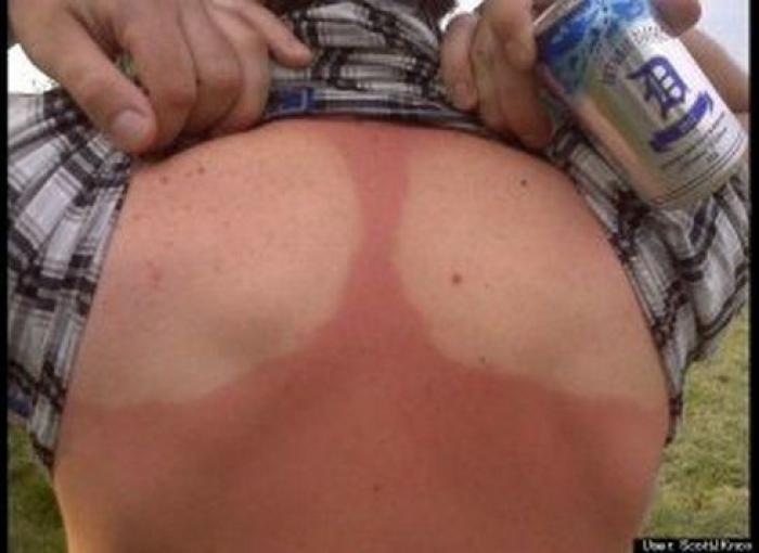 Quemaduras en la playa: 'tatuajes solares' que te pueden dejar los graciosos de tus amigos (FOTOS)