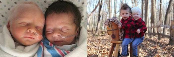 23 historias de bebés prematuros que demuestran que estos niños son unos luchadores