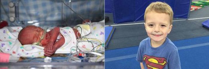 23 historias de bebés prematuros que demuestran que estos niños son unos luchadores