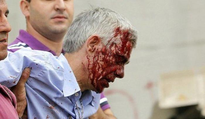 17 imágenes del accidente de Santiago difíciles de olvidar