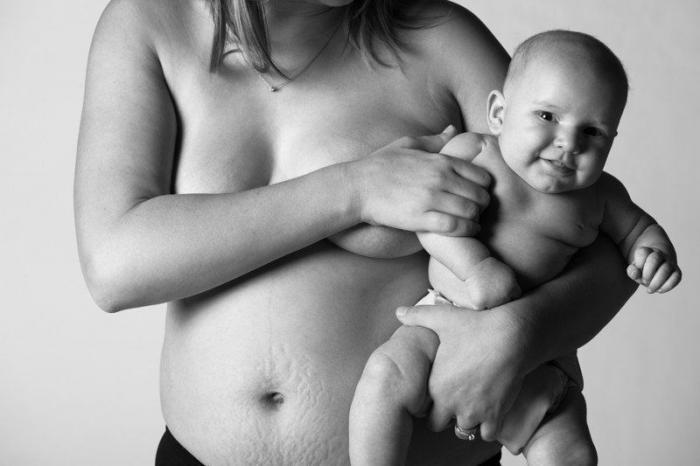 Madres sin Photoshop: la verdadera huella que dejan 9 meses de embarazo (FOTOS)