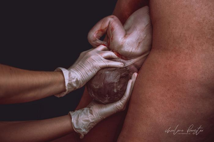 25 poderosas y realistas fotografías de partos