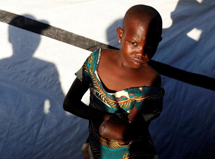Las víctimas de la guerra a machetazos en el Congo (fotos)