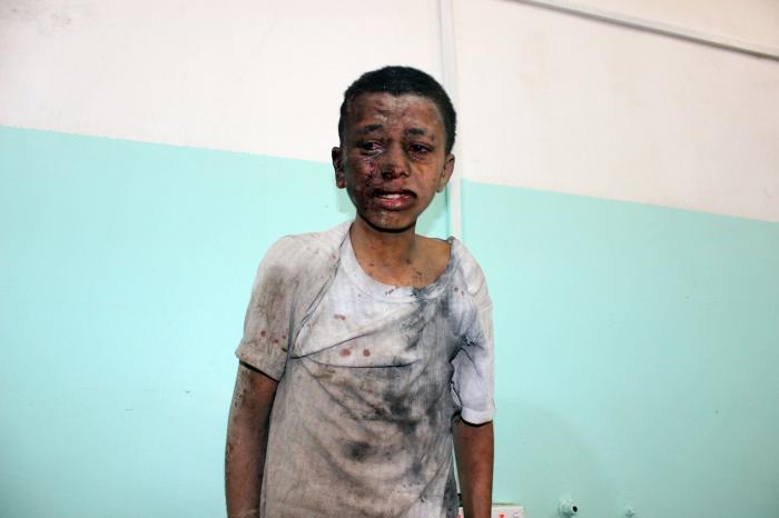 La ONU denuncia posibles crímenes de guerra de todas las partes en conflicto en Yemen