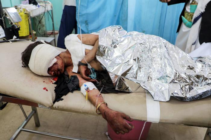 Todo lo que necesitas saber sobre el conflicto en Yemen