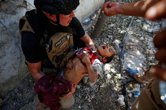 Un vídeo-puñetazo: las terribles imágenes de niños desnutridos en Mosul