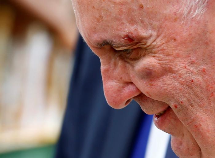 El papa Francisco se golpea con el papamóvil en la cara