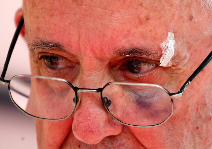 El papa Francisco se golpea con el papamóvil en la cara