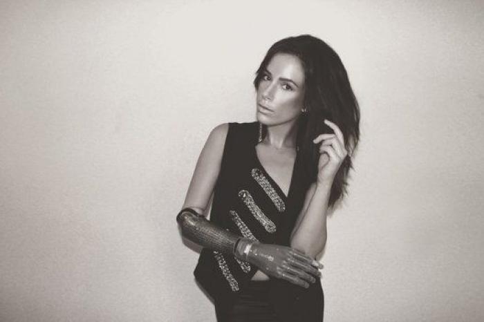 Rebekah Marine, la modelo con brazo biónico: "Luché demasiado tiempo contra mi imagen"