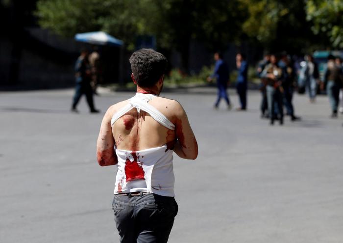 Al menos 80 muertos y más de 300 heridos por un atentado en Kabul