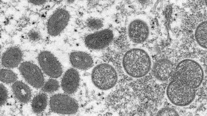 Sanidad confirma 23 muestras positivas en viruela no humana por PCR