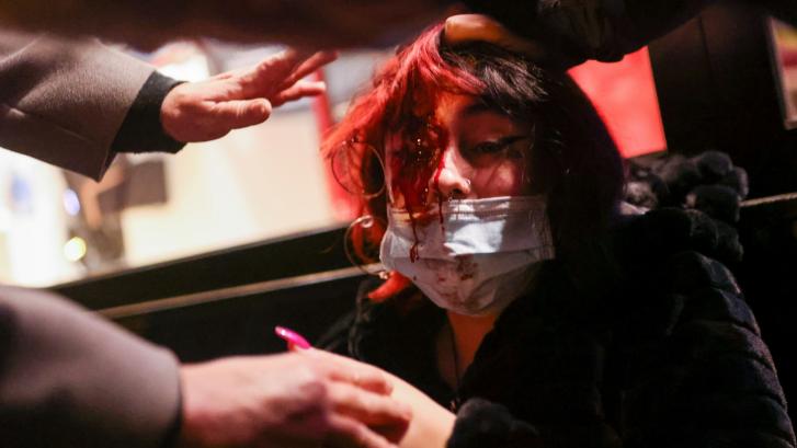 Una manifestante pierde un ojo en la protesta contra la condena a Pablo Hasel en Barcelona