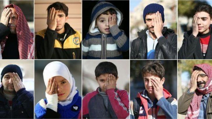 El bebé sirio convertido en símbolo de la resistencia tras perder un ojo